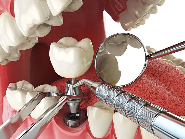 Professional Emergency Dental Service in NJ